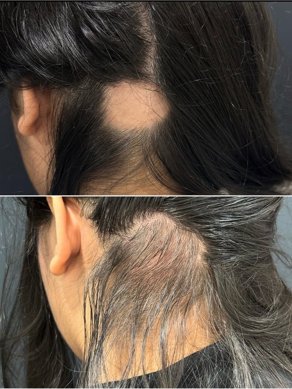 Rosemary With Biotin Hair Water Spray - White Set (2) - Picture 3 of 4